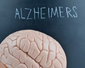 Alzheimers