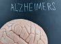 Alzheimers