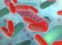 Legionella